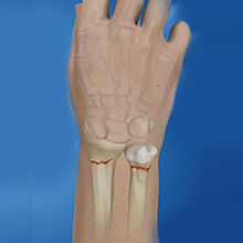 Hand/Wrist Injuries
