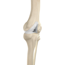 Normal Anatomy of the Knee Joint