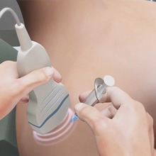 Ultrasound Guided Injections